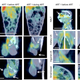 Illustration for article titled New Technique Reveals Where AIDS Hides In The Body – In Real Time